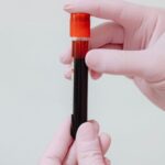 Close-up of gloved hands holding a blood test tube with red liquid against a white background.
