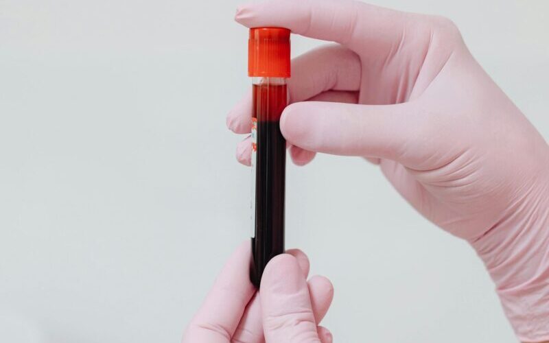 Close-up of gloved hands holding a blood test tube with red liquid against a white background.